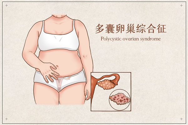 ѳۺʺԹ?